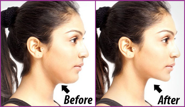 fabartdiy-5-easy-exercises-to-get-rid-of-double-chin-and-neck-fat-before-after